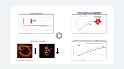 Samenvatting studieresultaten evolocumab uit het PROFICIO-programma