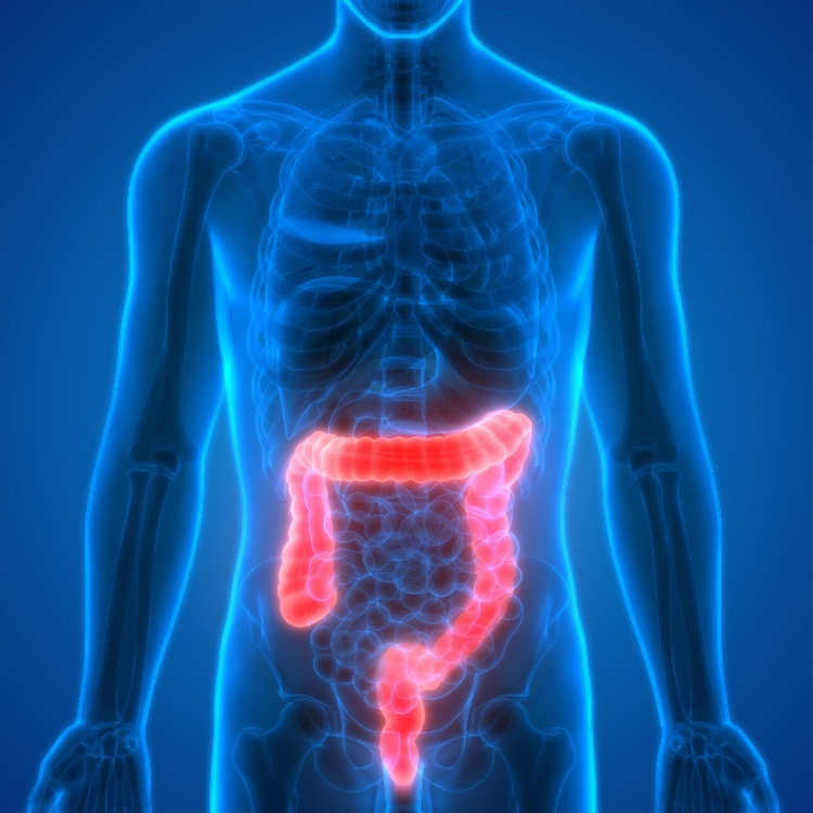 rood colon-rectum op blauwe achtergrond
