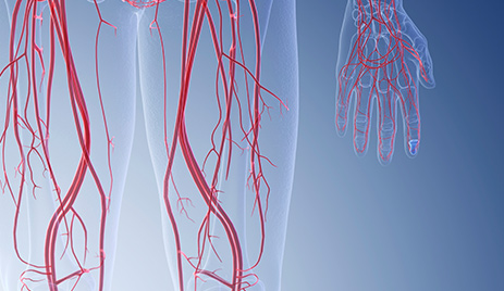 Menselijk lichaam met zichtbare bloedvaten om perifeer arteriaal vaatlijden af te beelden
