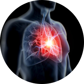 Menselijk lichaam met opgelicht hart om acuut coronair syndroom af te beelden