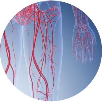 Menselijk lichaam met zichtbare bloedvaten om perifeer arteriaal vaatlijden af te beelden