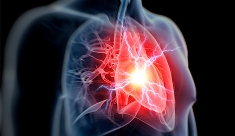 Menselijk lichaam met opgelicht hart om acuut coronair syndroom af te beelden