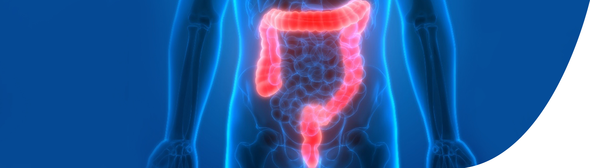 rood colon-rectum op blauwe achtergrond