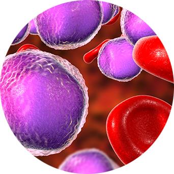 leukemie cellen tussen rode bloedcellen in een bloedvat