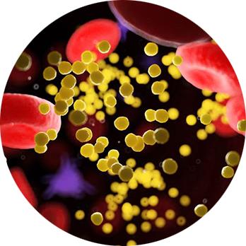 hypercholesterolemie