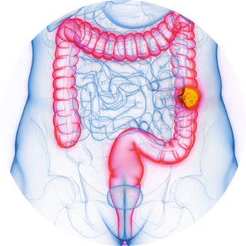 rood colon-rectum op wit-blauwe achtergrond